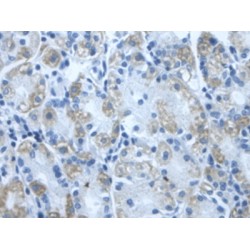 Dihydrolipoyl Dehydrogenase (DLD) Antibody