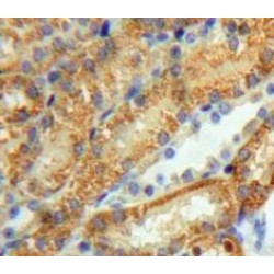 Dihydrolipoyl Dehydrogenase (DLD) Antibody