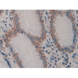 Dishevelled, Dsh Homolog 2 (DVL2) Antibody