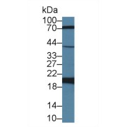 Western blot analysis of Goat Kidney lysate, using Sheep FTH Antibody (2 µg/ml) and HRP-conjugated Goat Anti-Rabbit antibody (<a href="https://www.abbexa.com/index.php?route=product/search&amp;search=abx400043" target="_blank">abx400043</a>, 0.2 µg/ml).