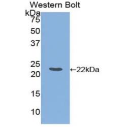 Ferritin, Light Polypeptide (FTL) Antibody