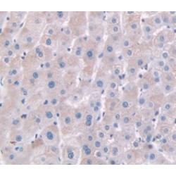 Haptoglobin Related Protein (HPR) Antibody