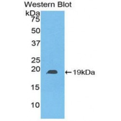 Heat Shock Protein Beta 6 (HSPb6) Antibody
