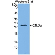 Western blot analysis of recombinant Human HO1.