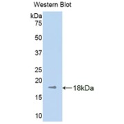 Western blot analysis of the recombinant protein.