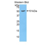 Western blot analysis of the recombinant protein.