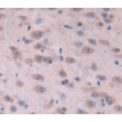 Kinesin Family, Member 5A (KIF5A) Antibody