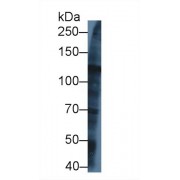 Western blot analysis of Human U2OS cell lysate, using Rat KIF5A Antibody (1 µg/ml) and HRP-conjugated Goat Anti-Rabbit antibody (<a href="https://www.abbexa.com/index.php?route=product/search&amp;search=abx400043" target="_blank">abx400043</a>, 0.2 µg/ml).