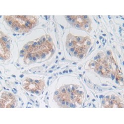 Matrix Metalloproteinase 3 / Stromelysin-1 (MMP3) Antibody