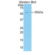 Western blot analysis of the recombinant protein.