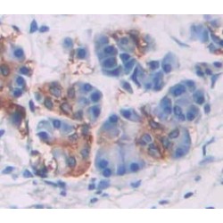 Sphingomyelin Phosphodiesterase 2 (SMPD2) Antibody