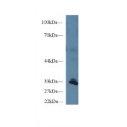 Western blot analysis of Human Liver lysate, using Human PPIE Antibody (1 µg/ml) and HRP-conjugated Goat Anti-Rabbit antibody (<a href="https://www.abbexa.com/index.php?route=product/search&amp;search=abx400043" target="_blank">abx400043</a>, 0.2 µg/ml).