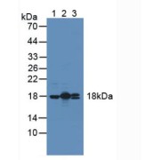 Western blot analysis of (1) Mouse Heart Tissue, (2) Rat Heart Tissue and (3) Human HeLa cells.