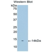 Western blot analysis of recombinant Human PSCA.