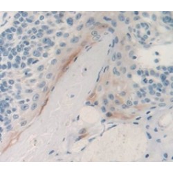 Prostate Stem Cell Antigen (PSCA) Antibody