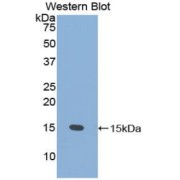 Western blot analysis of the recombinant protein.