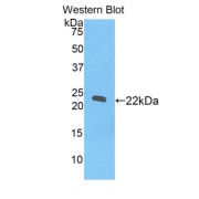 Western blot analysis of the recombinant protein.