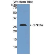 Western blot analysis of the recombinant protein.