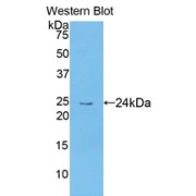 Western blot analysis of the recombinant protein.