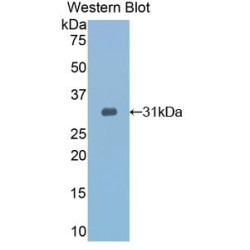 Toll Interacting Protein (TOLLIP) Antibody