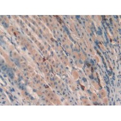 Toll Interacting Protein (TOLLIP) Antibody