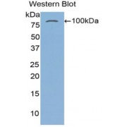 Western blot analysis of recombinant Human TGM2 protein.