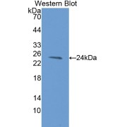 Western blot analysis of the recombinant protein.