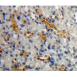 Anterior Gradient Protein 2 (AGR2) Antibody