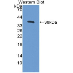 Carboxypeptidase B1, Tissue (CPB1) Antibody