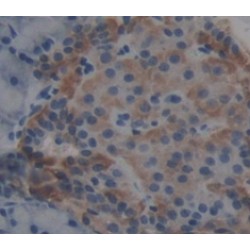 Carboxypeptidase B1, Tissue (CPB1) Antibody