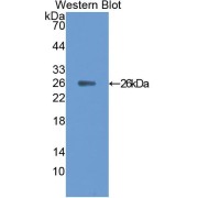 Western blot analysis of the recombinant protein.