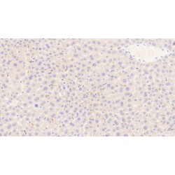 Scavenger Receptor Cysteine-Rich Type 1 Protein M130 (CD163) Antibody