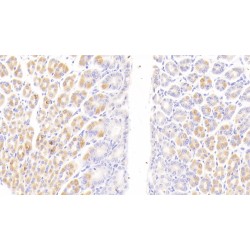 Scavenger Receptor Cysteine-Rich Type 1 Protein M130 (CD163) Antibody