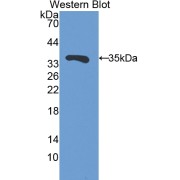 Western blot analysis of the recombinant protein.