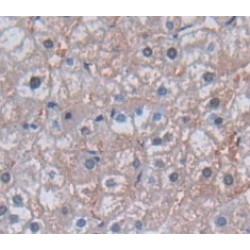 Glutathione Hydrolase 1 Proenzyme (GGT1) Antibody