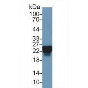 Western blot analysis of Human Lung lysate, using Human HSPB1 Antibody (3 µg/ml) and HRP-conjugated Goat Anti-Rabbit antibody (<a href="https://www.abbexa.com/index.php?route=product/search&amp;search=abx400043" target="_blank">abx400043</a>, 0.2 µg/ml).