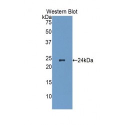 Heat Shock Protein Beta-1 (HSPB1) Antibody