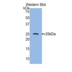 Heat Shock Protein Beta-1 (HSPB1) Antibody