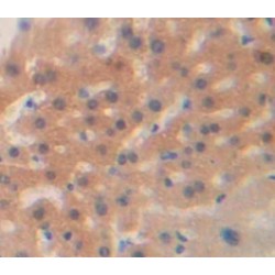 Heat Shock Protein Beta-1 (HSPB1) Antibody