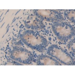 Heat Shock 70 kDa Protein 8 (HSPA8) Antibody