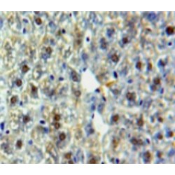 Heat Shock 70 kDa Protein 9 (HSPA9) Antibody