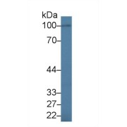 Western blot analysis of Human BXPC3 cell lysate, using Human IL17RA Antibody (1.5 µg/ml) and HRP-conjugated Goat Anti-Rabbit antibody (<a href="https://www.abbexa.com/index.php?route=product/search&amp;search=abx400043" target="_blank">abx400043</a>, 0.2 µg/ml).