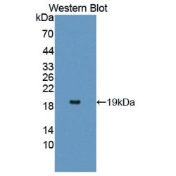 Interleukin 17 Receptor A (IL17RA) Antibody