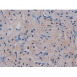 Interleukin 17 Receptor A (IL17RA) Antibody