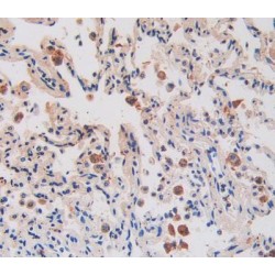 Interleukin 17 Receptor A (IL17RA) Antibody