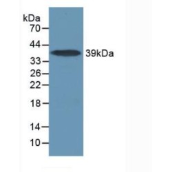 Interleukin 17 Receptor A (IL17RA) Antibody