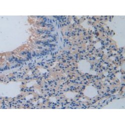 Interleukin 17 Receptor A (IL17RA) Antibody