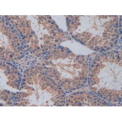 Interleukin 17 Receptor A (IL17RA) Antibody