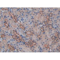 Interleukin 17 Receptor A (IL17RA) Antibody