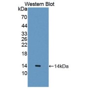 Western blot analysis of the recombinant protein.